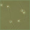 2012-1-sperm.jpg