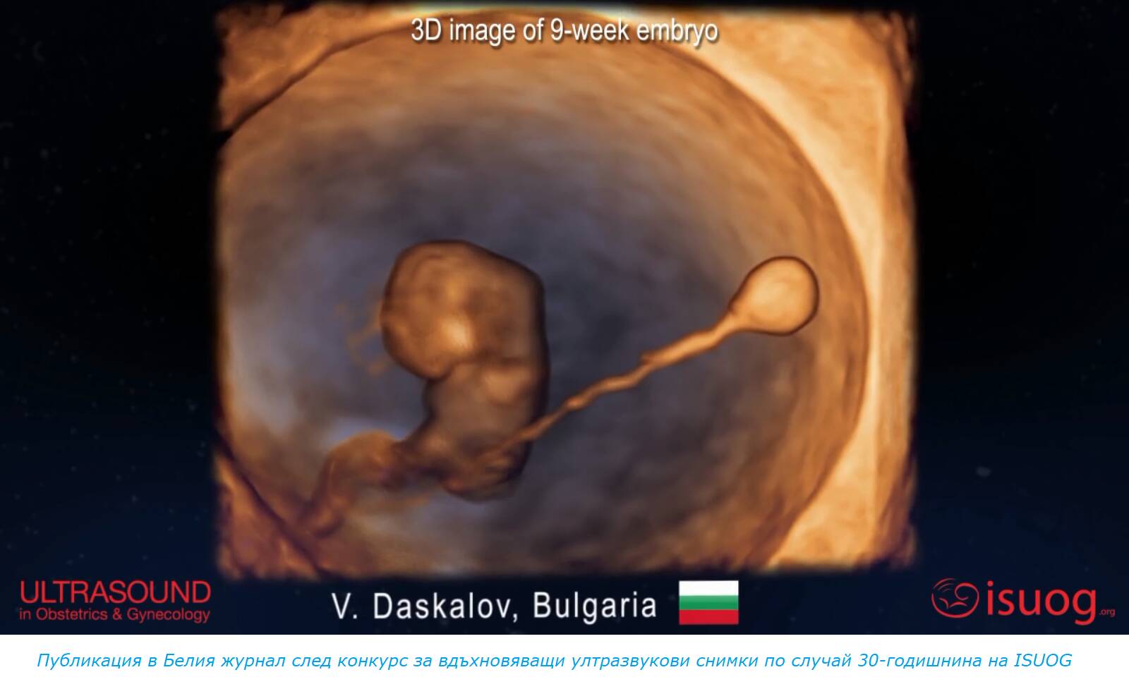 Daskalov, Bulgaria, UOG