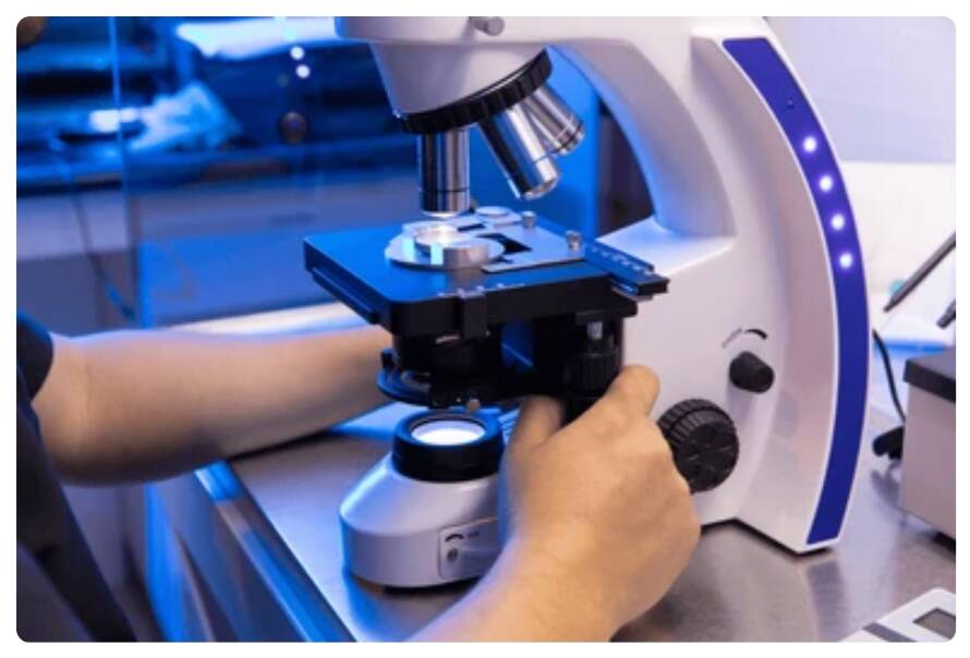 astenozoospermia