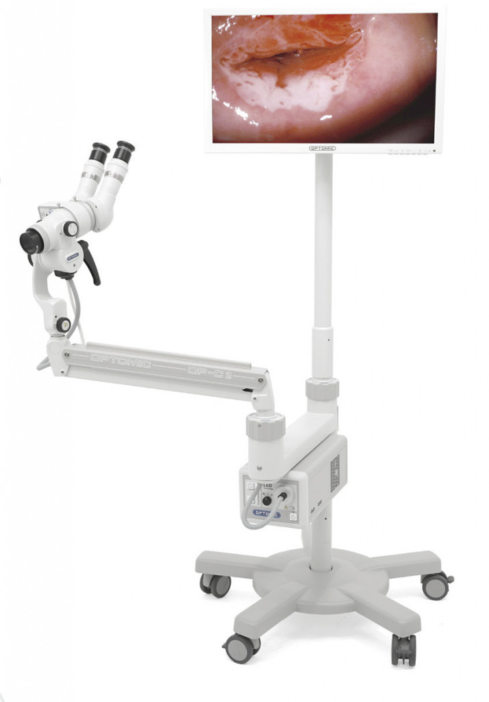 colposcope-and-screen-holder