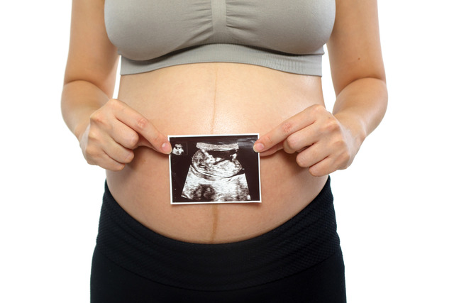 Closeup of a pregnant woman holding ultrasound picture on white